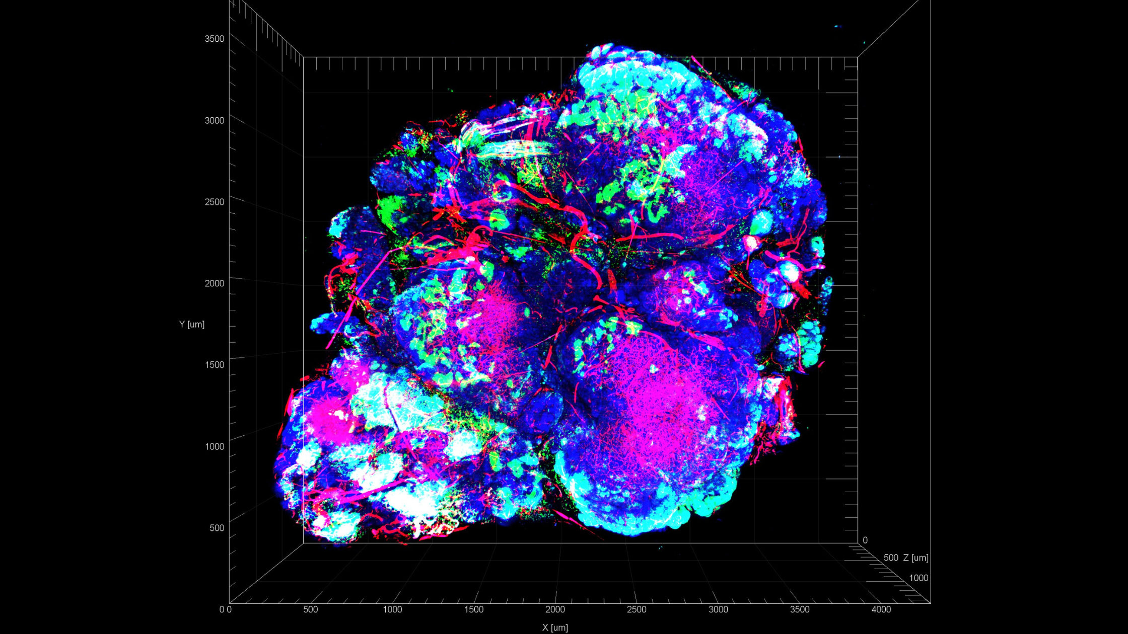 Engineered Bacteria for Cancer Therapy: How Programmable Microbes Target Tumors